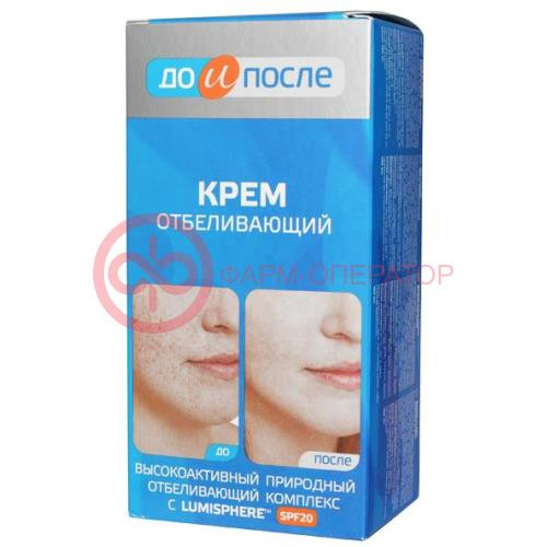 До и после крем 100мл отбел